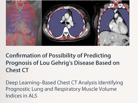 ation of Possibility of Predicting Prognosis of Lou Gehrig's Disease Based on Chest CT  Deep Learning&ndash;Based Chest CT Analysis Identifying Prognostic Lung and Respiratory Muscle Volume Indices in ALS  READ MORE 