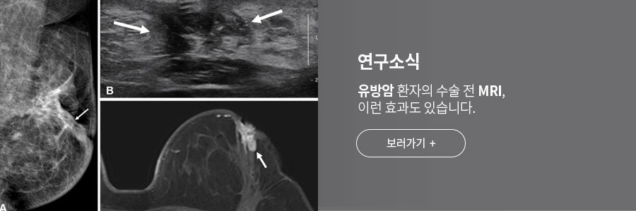 [연구소식] 유방암 환자의 수술 전 MRI, 이런 효과도 있습니다.