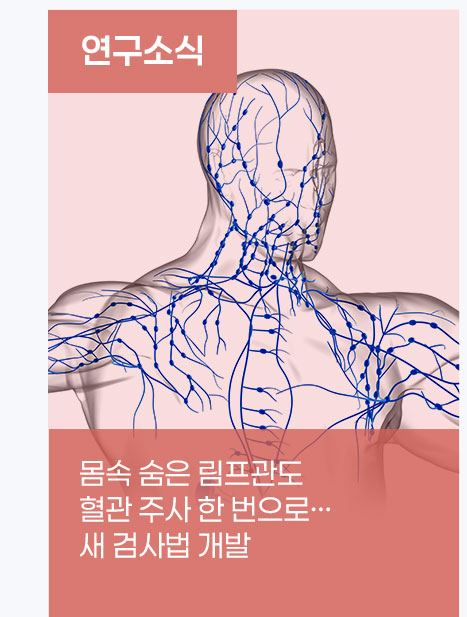 몸속 숨은 림프관도 혈관 주사 한 번으로&hellip; 새 검사법 개발